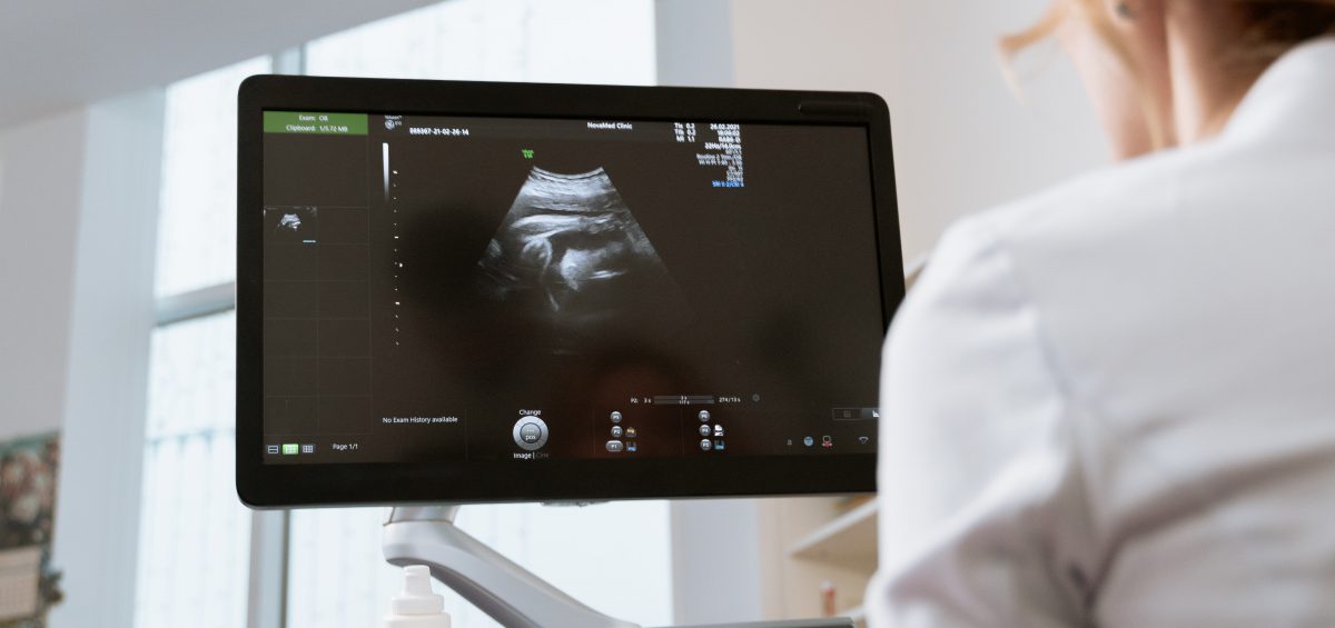 Guide to Accessing Safe Abortions